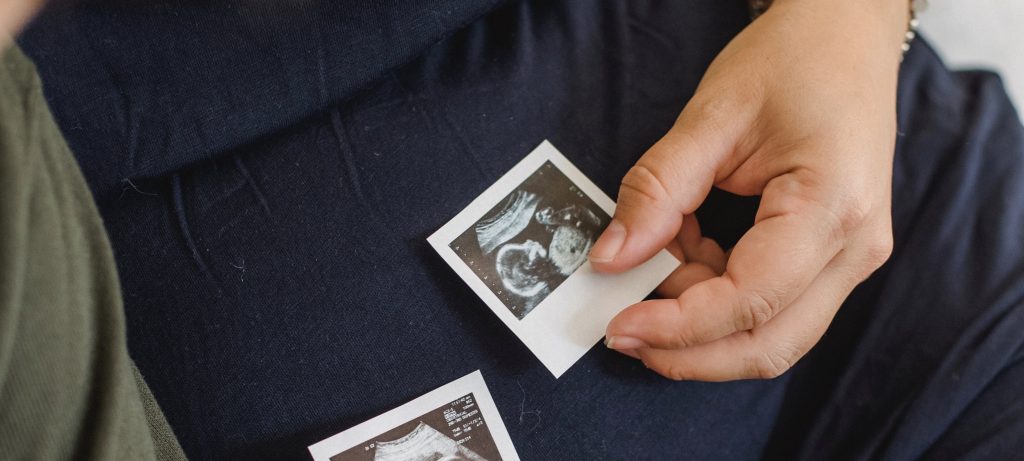 Pregnancy Journey so far with stock image